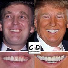 Donald Trump before dental work